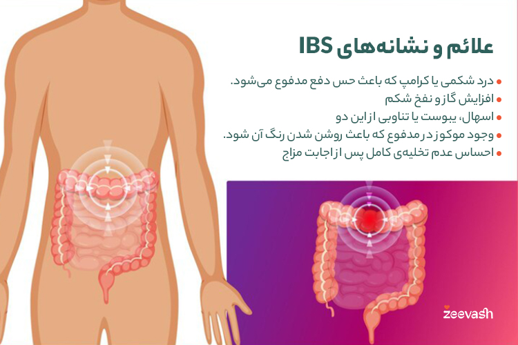 علائم و نشانه‌های IBS چه‌چیزهایی هستند؟